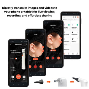 0 °/30 ° Otoscope Auriscope 4x60mm ENT Rigid Endoscope Ear Speculum Fit Storz Wo 0 °/30 ° Otoscope Auriscope 4x60mm ENT Rigid Endoscope Ear Speculum Fit Storz Wo